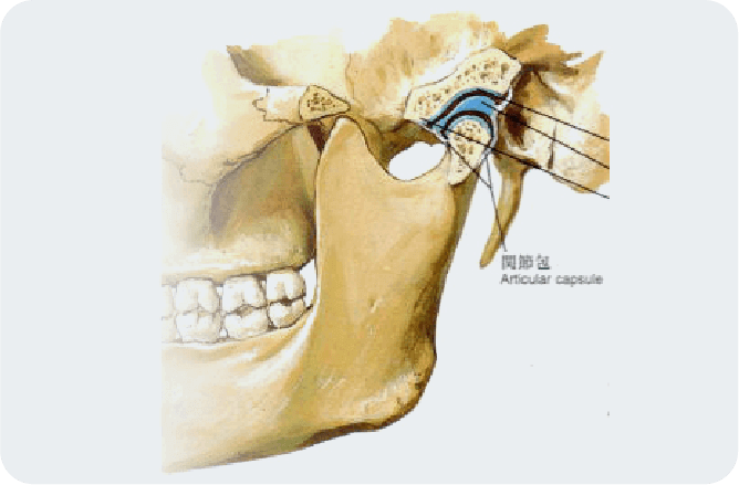 顎関節症のイメージ
